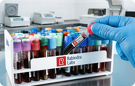 Sample received at lab